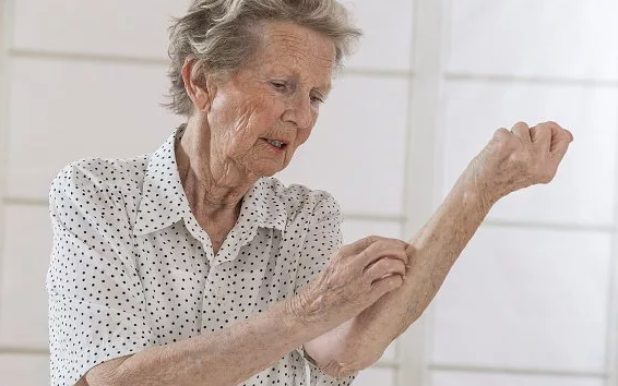 Старческий зуд кожи у пожилых людей причины, лечение и профилактика
