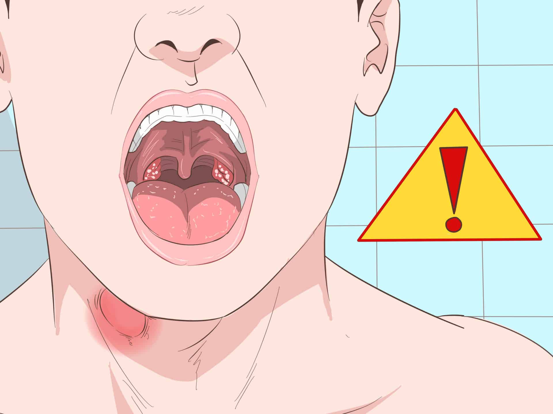 Причины мокроты в горле