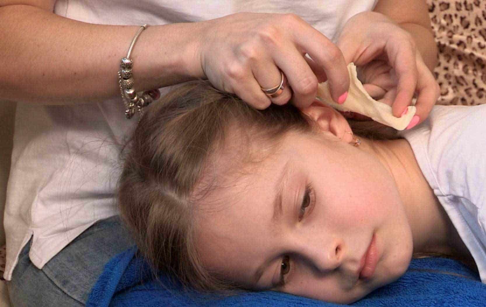 Как сделать компресс на ухо ребенку фото