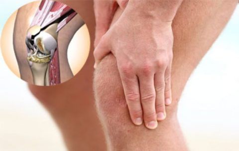 Артрит коленей имеет большой диапазон признаком в зависимости от вида недуга.