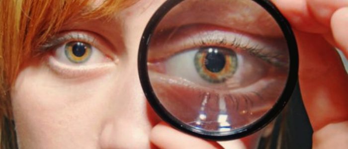 Глаукома и близорукость