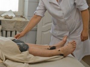 Для лечения остеоартроза применяют методы физиотерапии, например, грязелечение.