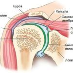 Фиброзные изменения синовиальной оболочки плеча иногда становятся предпосылкой для развития капсулита.