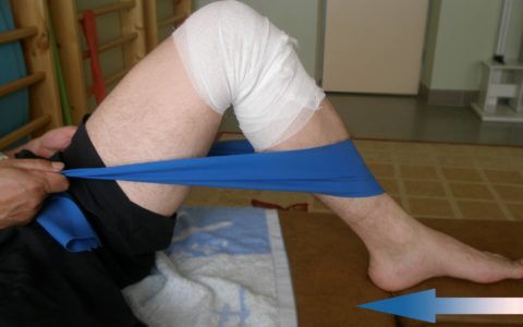 Фиксация ноги после проведённого хирургического вмешательства.