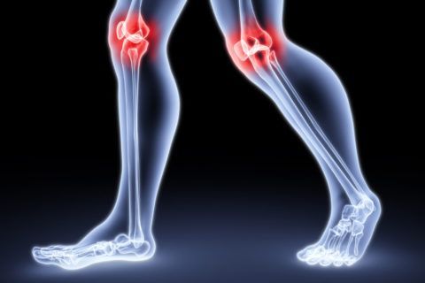 Характерные проявления артрита  - это боль и хруст в суставе