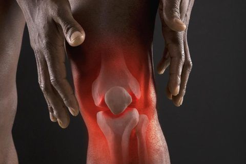 К артриту могут приводить различные инфекции в организме.