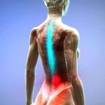 К защемлению нерва в сочленении может приводить спазм мышц различной этиологии.