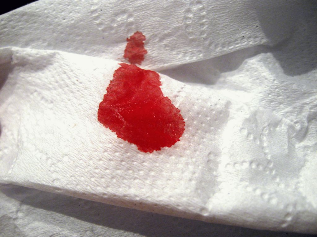 Выделение крови после похода в туалет