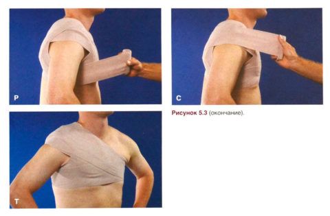 А вы умеете правильно перевязать плечевой сустав и завязать бинт?