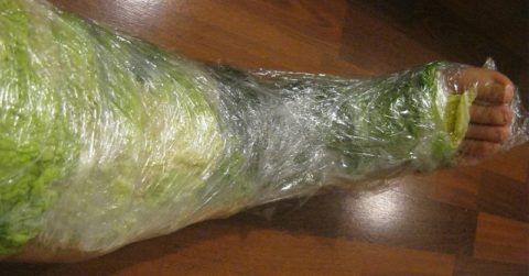 Компресс из капустного листа, применяемый на обширную поверхность ноги. Зафиксирован пищевой плёнкой для удобства в применении.