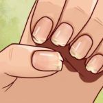 Ломкость ногтей свидетельствует, что организму не хватает витаминов и микро- макроэлементов