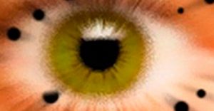 Причины и лечение ретинопатии