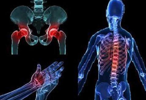 Остеопороз – проблема костей и околосуставной области