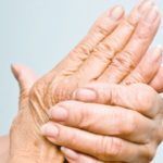 Остеопороз кистей рук может стать следствием ревматоидного артрита.