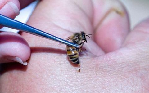 Пчелы – отличные лекари, особенно если речь идет об артралгии