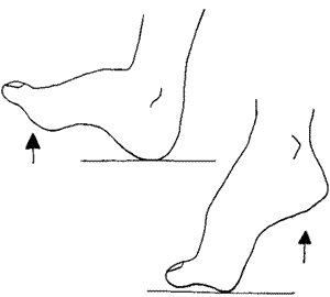 Перекаты стопы являются профилактикой «скрипа» ноги при ходьбе.