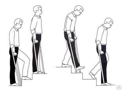 Подниматься и спускаться по лестнице в восстановительный период на колене надо с осторожностью.