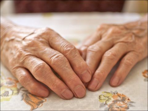 Поражение суставов пальцев рук — самая частая патология среди артрозов