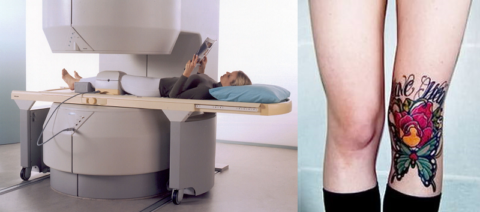 При МРТ колена татуировка на ноге может стать причиной образования сильного ожога