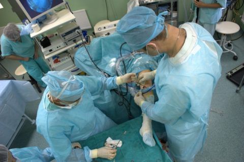 Проведение вмешательства с использованием артроскопа в операционной хирургического отделения.