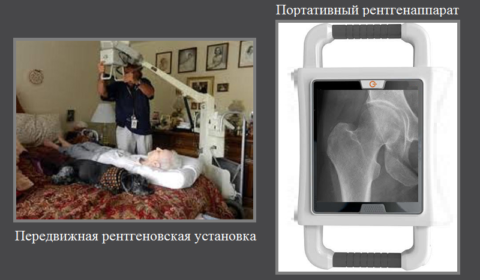 Сегодня рентгеновский снимок тазовой области можно сделать и в домашних условиях