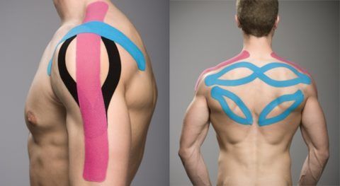 Тейпирование плечевого сустава и мышц верхней части спины
