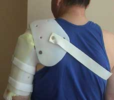 Тутор на плечо помогает восстановиться после травм.