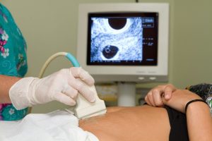 Как по пульсу определить беременность?