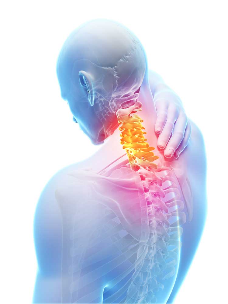Боль в шее – одна из частых причин проведения МРТ-исследования.