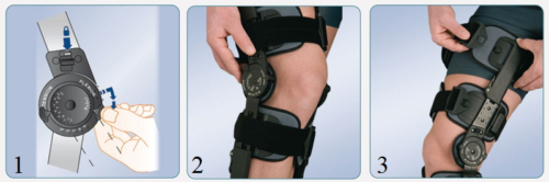 Порядок действий при надевании брейса на колено с боковой фиксацией