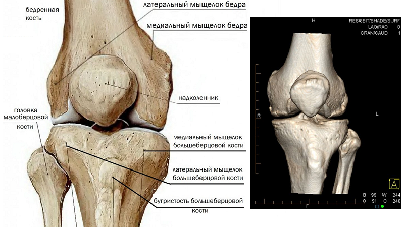 Рисунок и 3-d снимок коленного сустава в норме (на основе КТ-обследования)