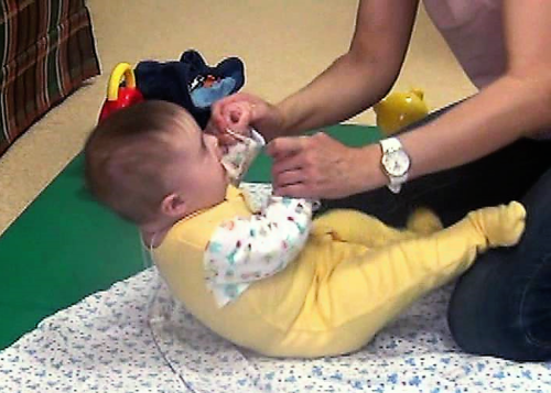 У младенцев в норме могут хрустеть позвоночник, тазобедренные сочленения и колени